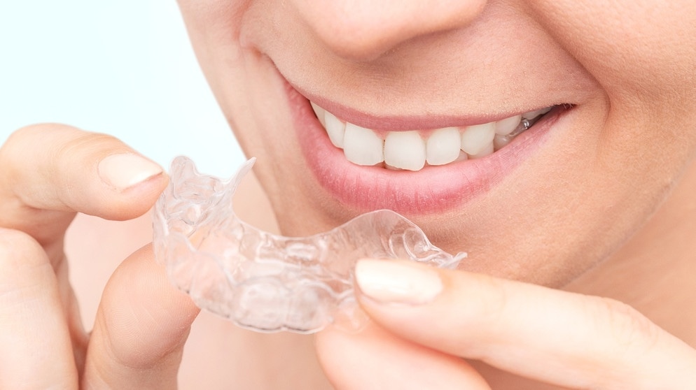 Transparente Unsichtbare Zahnspange für kleinere und größere kieferorthopädische Probleme