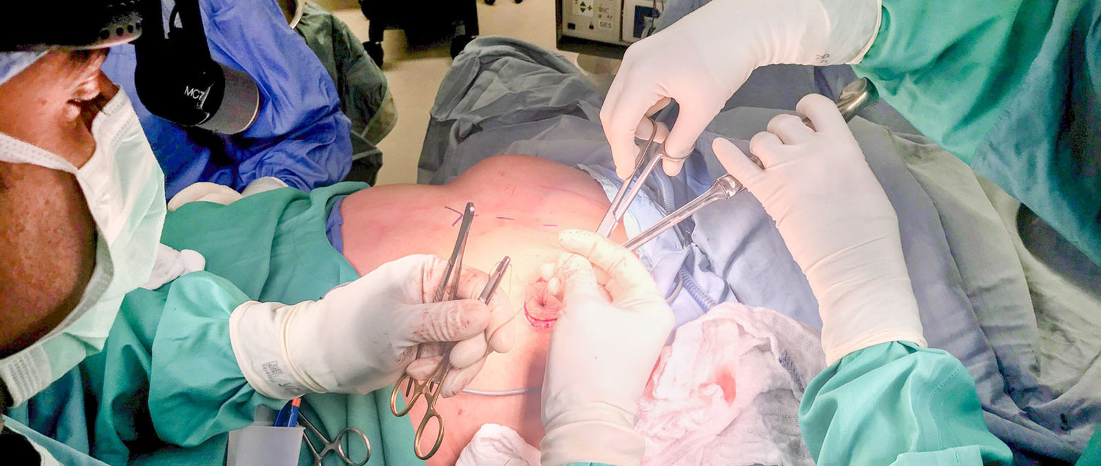 Die besten Kliniken für Brustvergrößerung mit Straffung in Deutschland