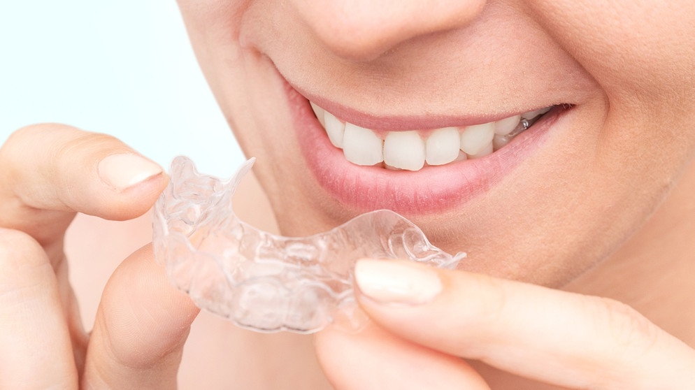 Transparente Unsichtbare Zahnspange für kleinere und größere kieferorthopädische Probleme